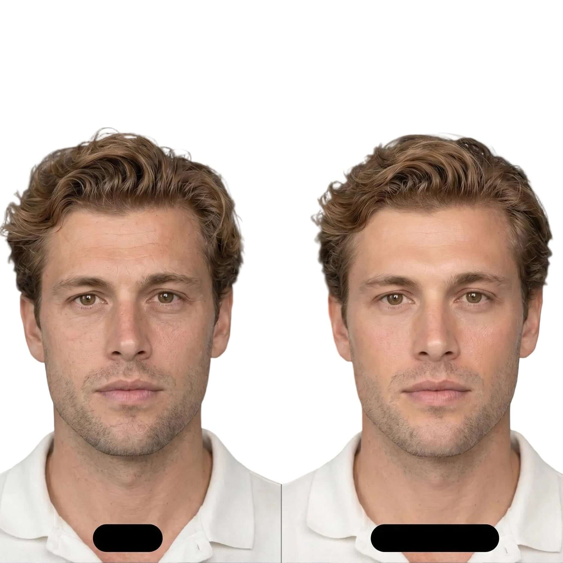 Before and after effect of using Bakuchiol Night Oil Serum on men's skin showing smoother appearance.