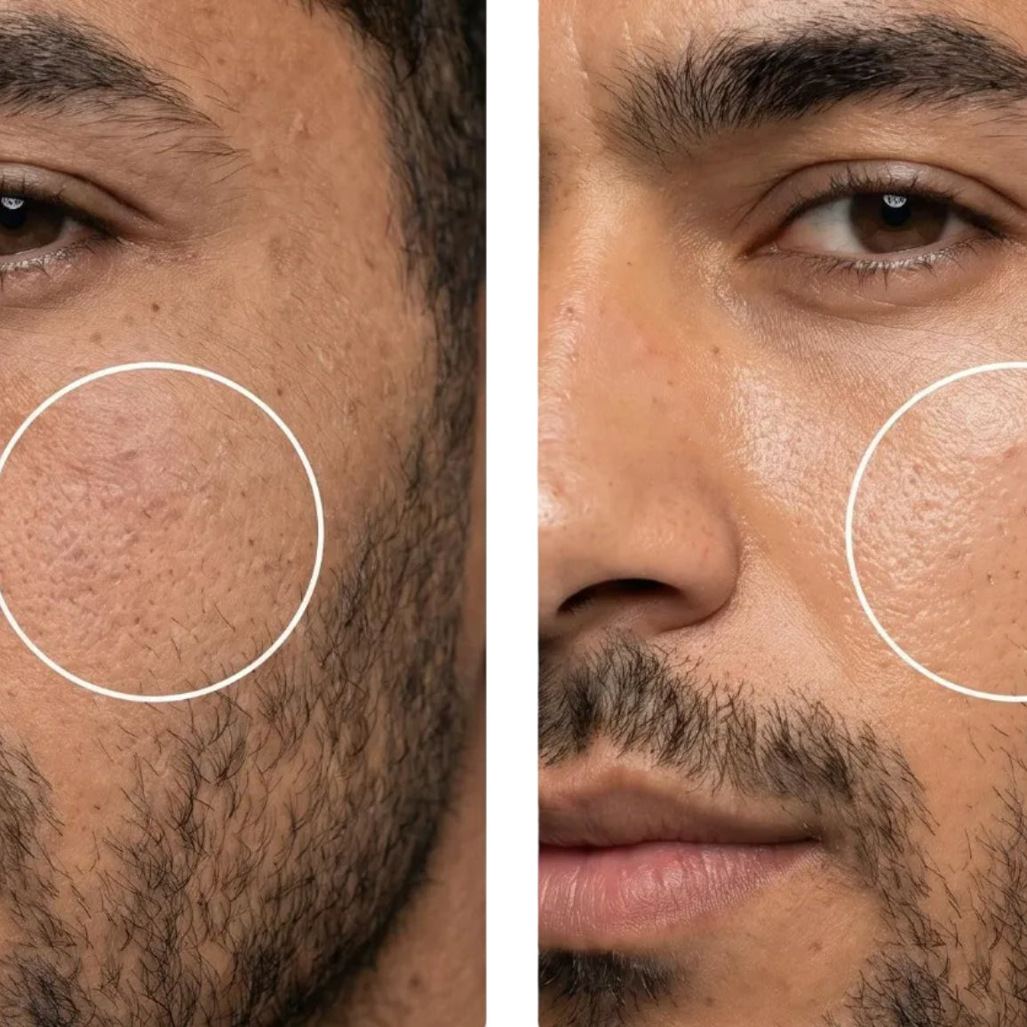 Before and after treatment showing skin texture improvement with All-In-One Facial Oil.